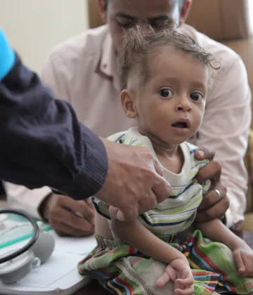 A boy is screened for malnutrition in Sa’ada, Yemen, Thursday 20 October 2016. Nearly 182,000 children in Yemen were treated for severe acute malnutrition as of October 2016.