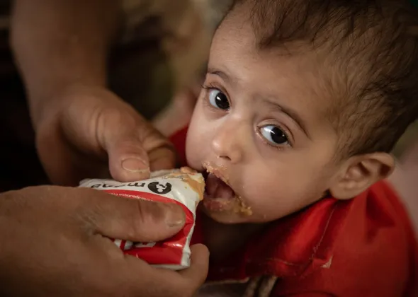 Arwa Al-Oshari, 14 month old, who is suffering from malnutrition, being given the prescribed supplements to help her