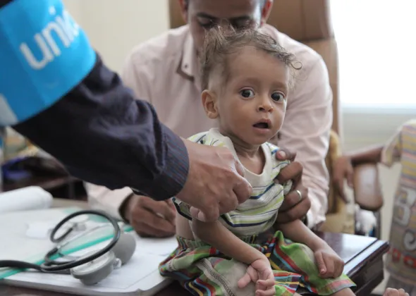 A boy is screened for malnutrition in Sa’ada, Yemen, Thursday 20 October 2016. Nearly 182,000 children in Yemen were treated for severe acute malnutrition as of October 2016.
