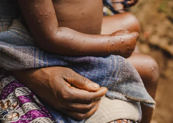 ©UNICEF/UNI624811/Benekire