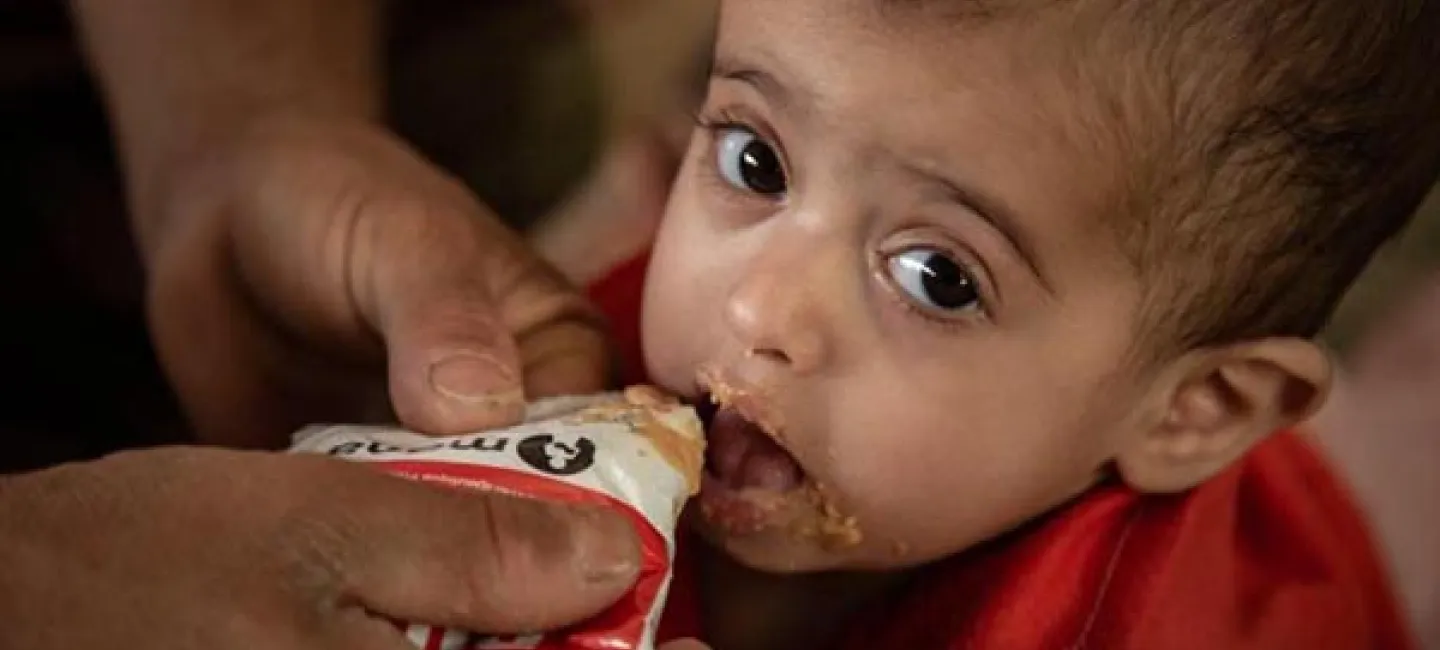 Unicef-2020-March-Malnutrition_Mareb
